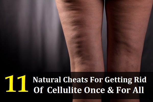 11 Cheats naturelles pour se débarrasser de la cellulite Once & amp; Pour tous