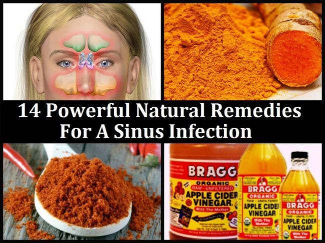 14 Remèdes naturels puissant pour une infection des sinus