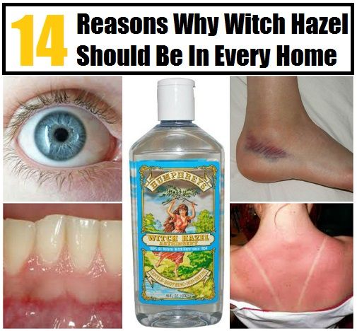 14 raisons pour lesquelles Witch Hazel doit être dans tous les foyers