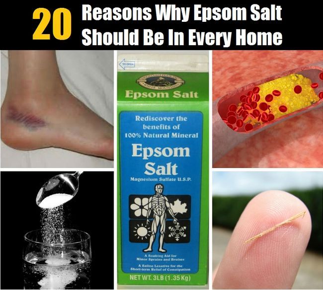 20 raisons pour lesquelles l'esprit souffle Epsom sel doit être dans tous les foyers