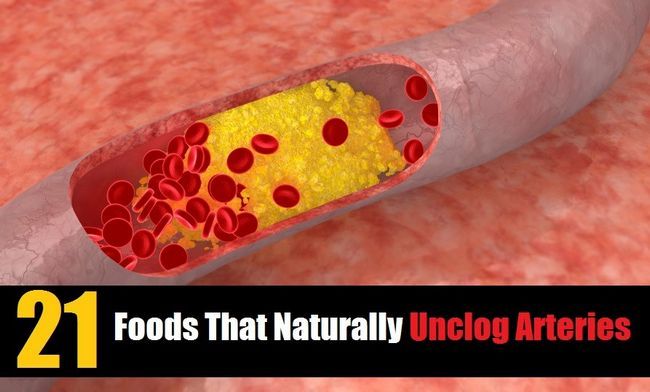 21 aliments qui désengorger Naturellement artères