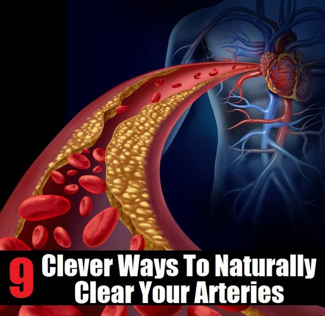9 façons de Clever Naturellement claires artères