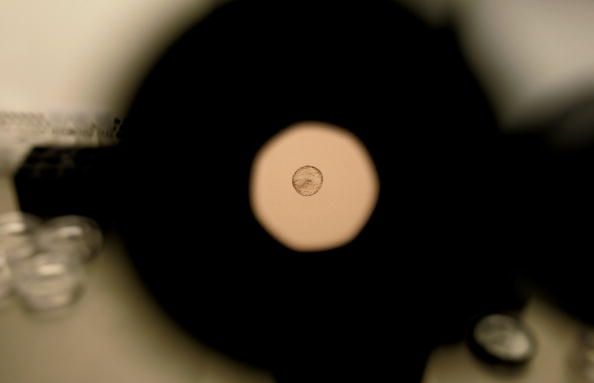 Un embryon humain, comme on le voit à travers un microscope.