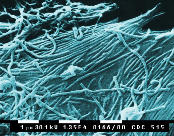 Électronique à balayage image microscopique de virions d'Ebola.
