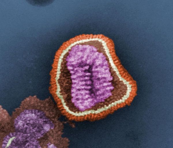 Virus de la grippe