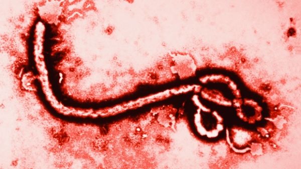 CDC confirme que le patient à Miami n'a pas le virus Ebola.