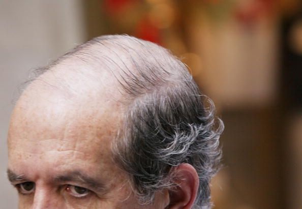 La plupart des hommes souffrent de la perte de cheveux: remèdes naturels qui fonctionnent réellement