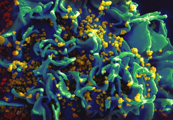 Des cellules T H9 infectées par le VIH