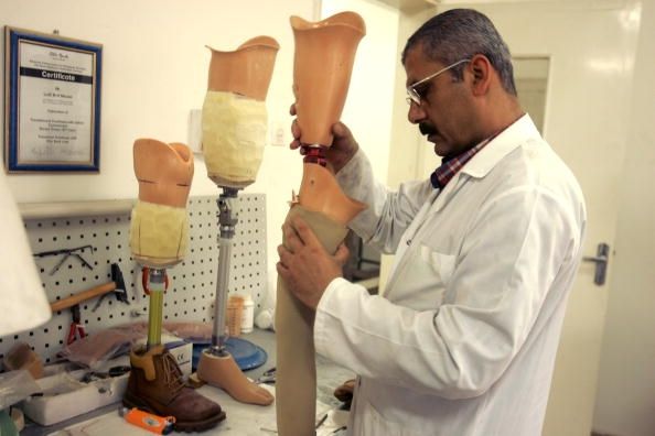 Prothèses peuvent maintenant être sur son chemin après une'artificial skin' showed natural-like function