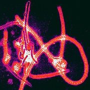Le virus Ebola - le monde médical est encore à apprendre à propos de complications tardives à des infections graves Ebola.