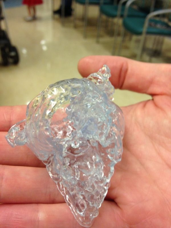 Coeur en 3D a permis aux médecins de formuler une stratégie avant d'opérer sur un bébé's actual heart.