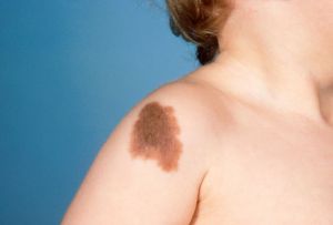Top liste des 10 problèmes les plus courants de la peau
