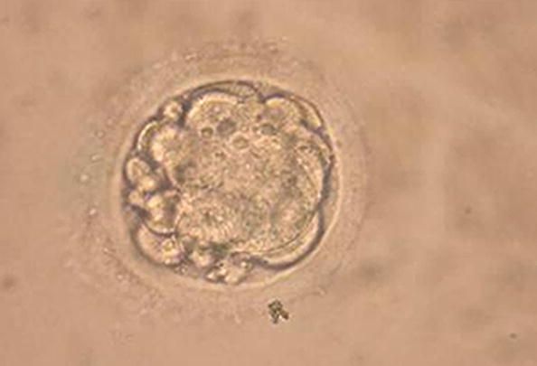 Un enbryo humain.