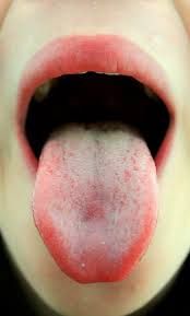 Votre langue dit votre médecin beaucoup de choses sur votre santé.
