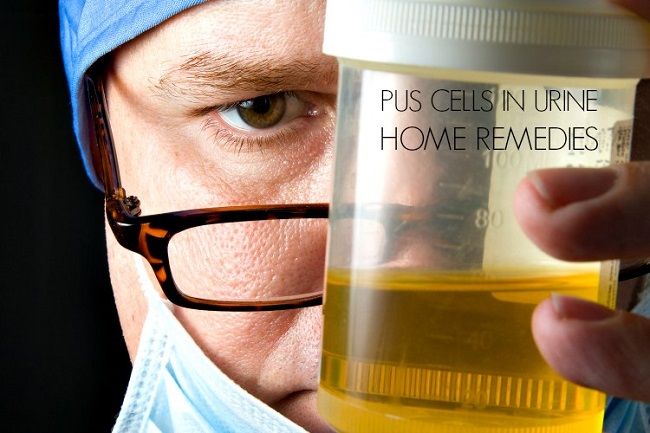 18 remèdes maison de bricolage pour les cellules de pus dans les urines