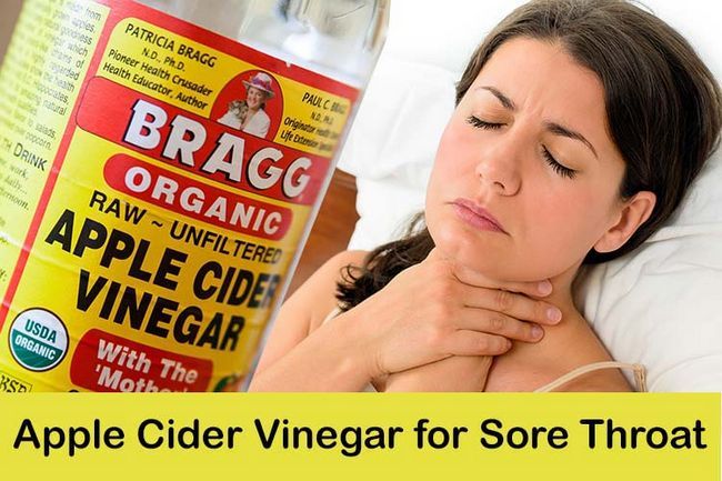 Apple Cider Vinegar pour le mal de gorge