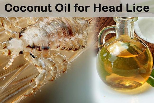 L'huile de coco pour les poux de tête