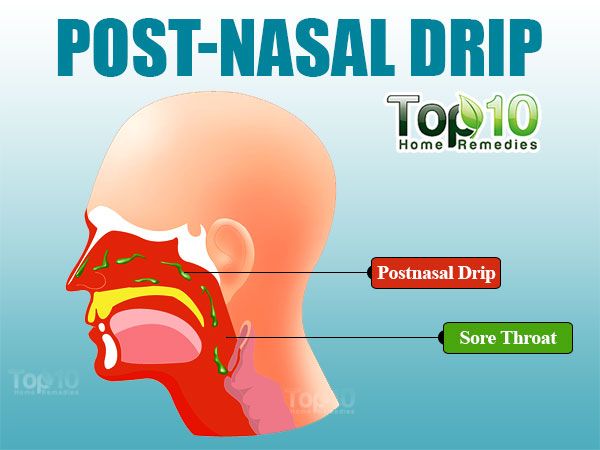 accueil-recours-pour-post-nasal-drip-page-3-sur-3