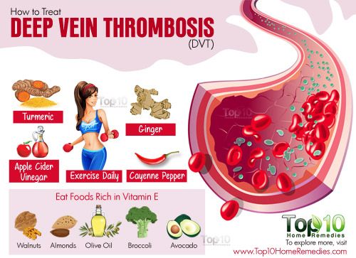 comment faire face à la thrombose veineuse profonde
