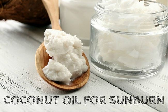 Comment utiliser l'huile de noix de coco pour les coups de soleil (13 méthodes)