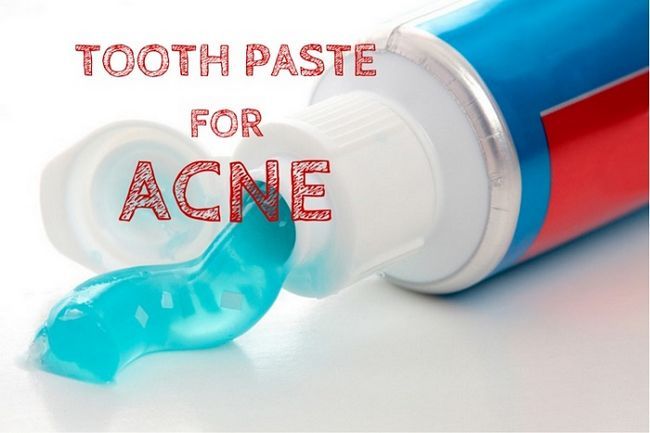 pâte dentifrice pour l'acné