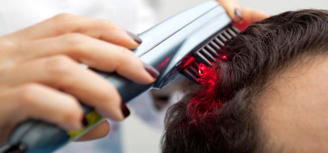 Laser Therapy: un nouvel outil pour lutter contre la perte de cheveux