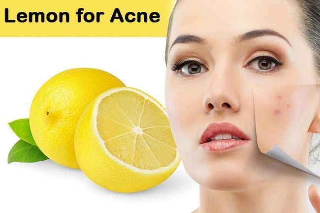 Citron pour l'acné