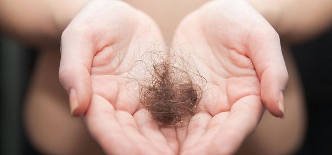 Top 5 des Cures permanents pour traiter la perte des cheveux