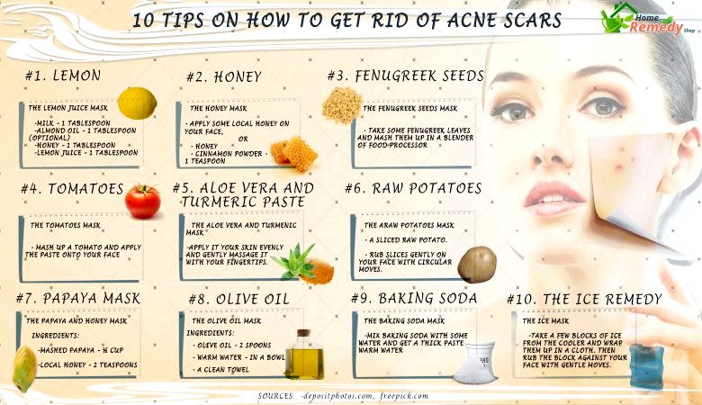 10 conseils sur la façon de se débarrasser des cicatrices d'acné