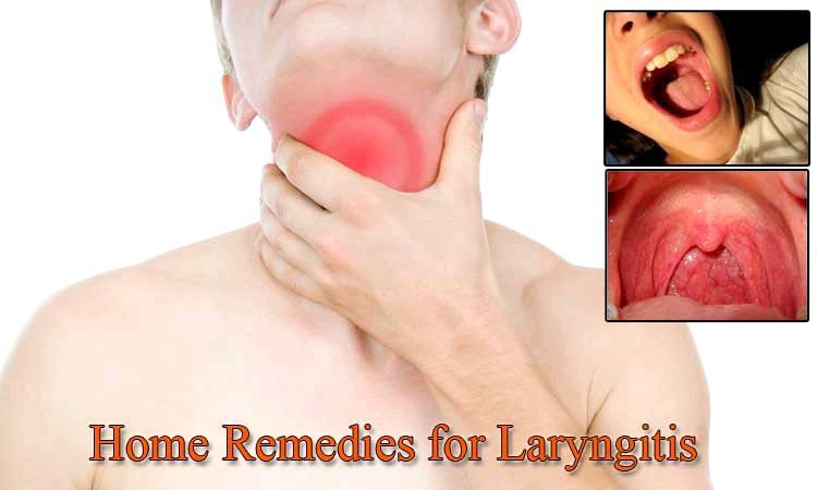 25 Accueil recours pour laryngite