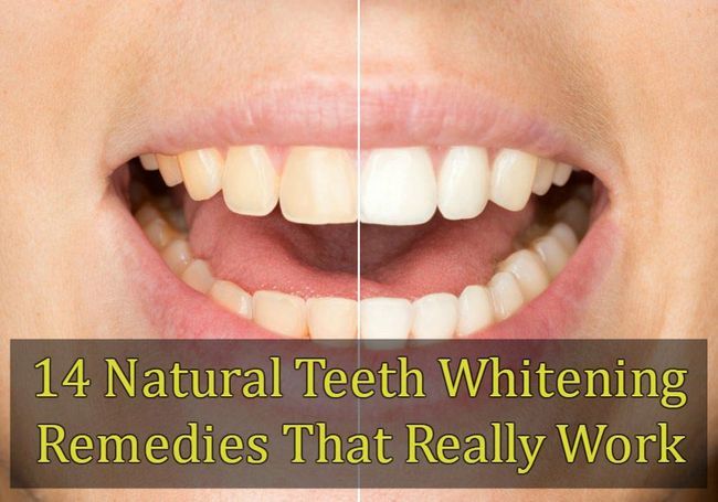 14 dents naturelles blanchissant remèdes qui fonctionnent vraiment