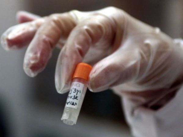 19e sérothérapie passive siècle peut être la clé de la formulation d'un remède pour le virus Ebola.