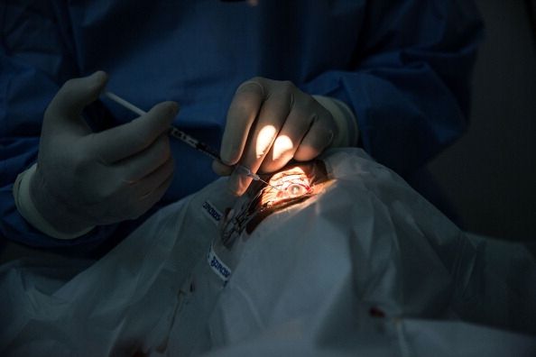 72-year-old femme reçoit implant œil bionique à Honolulu