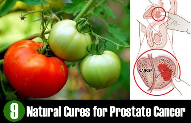 Remèdes naturels pour cancer de la prostate