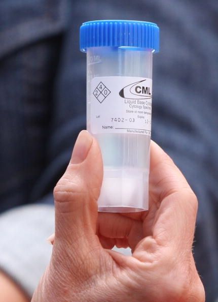 Un flacon maintenir un échantillon pour un test de Pap.