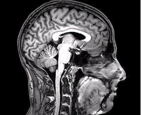 Les chercheurs sont dreating un outil qui peut aider à prédire qui est à risque de problèmes de mémoire et de la cognition. Les chercheurs sont dreating un outil qui peut aider à prédire qui est à risque de problèmes de mémoire et de la cognition.
