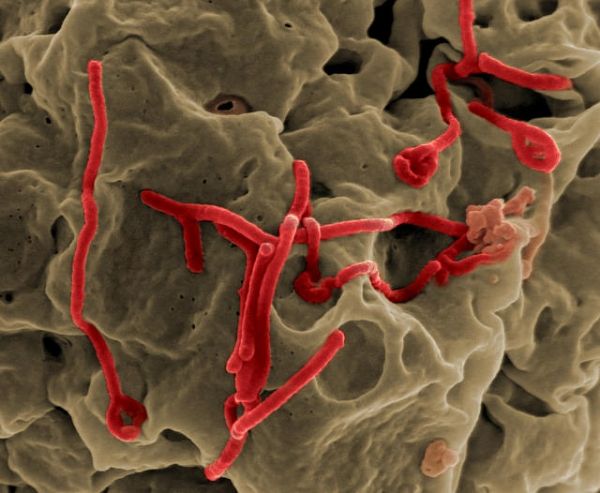 Micrographie électronique à balayage du virus Ebola en herbe de la surface d'une cellule Vero (ligne africaine de cellules de rein de singe vert épithéliale).
