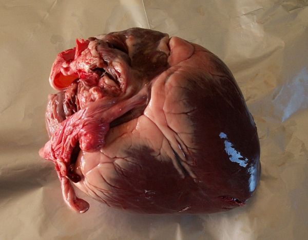 Médecins australiens transplanter cœurs morts succès