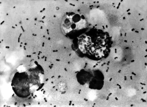 Un regard microscopique à la bactérie responsable de la peste.