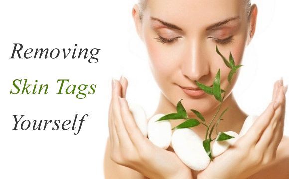 à base de plantes-traitements à enlever la peau balises