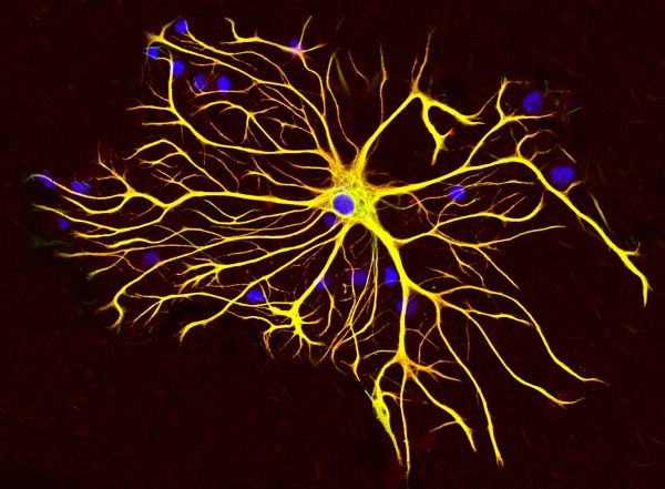 Les cellules du cerveau se régénèrent après un AVC: nouvelle étude