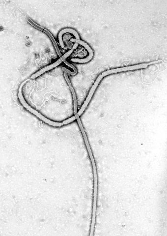 Transmission Microscopie électronique du virus Ebola. Fièvre hémorragique, virus à ARN