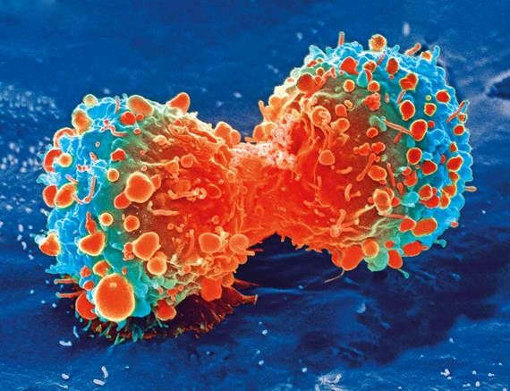 Classification cancer devrait inclure des types génétiques et moléculaires