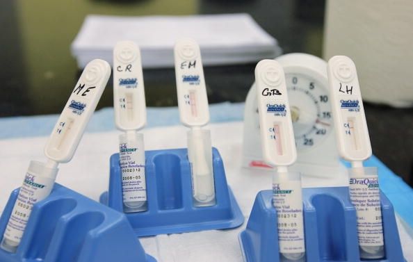 Cdc reçoit de l'air à l'aide de l'Indiana pour une éventuelle épidémie de VIH