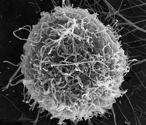 Micrographie électronique à balayage des particules filamenteuses Ebola en herbe à partir d'une seule cellule VERO E6 chroniquement infectés (25,000x grossissement).