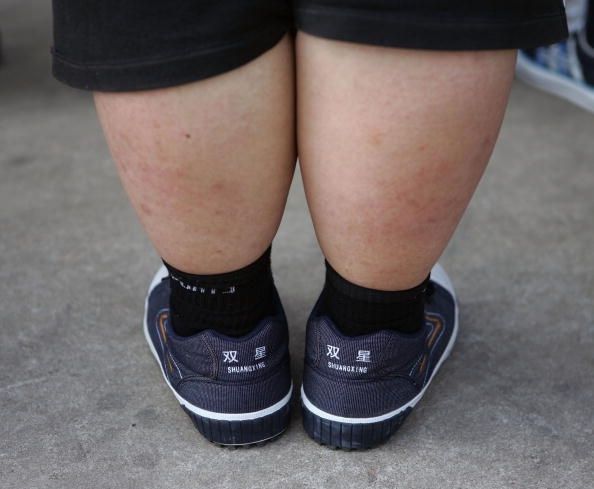Hormone défectueux lié à l'obésité sévère chez un bambin