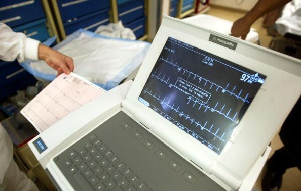 Moniteur de fréquence cardiaque Moniteur de fréquence cardiaque