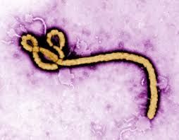 Ebola aux Etats-Unis