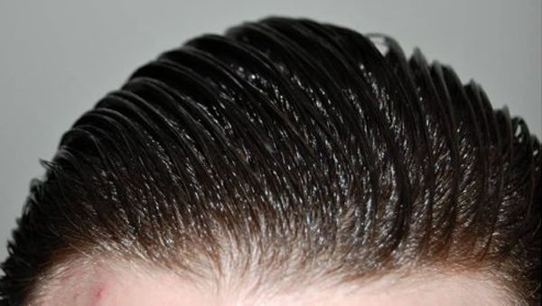 Remèdes à la maison pour les cheveux gras
