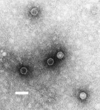 Entérovirus 68
